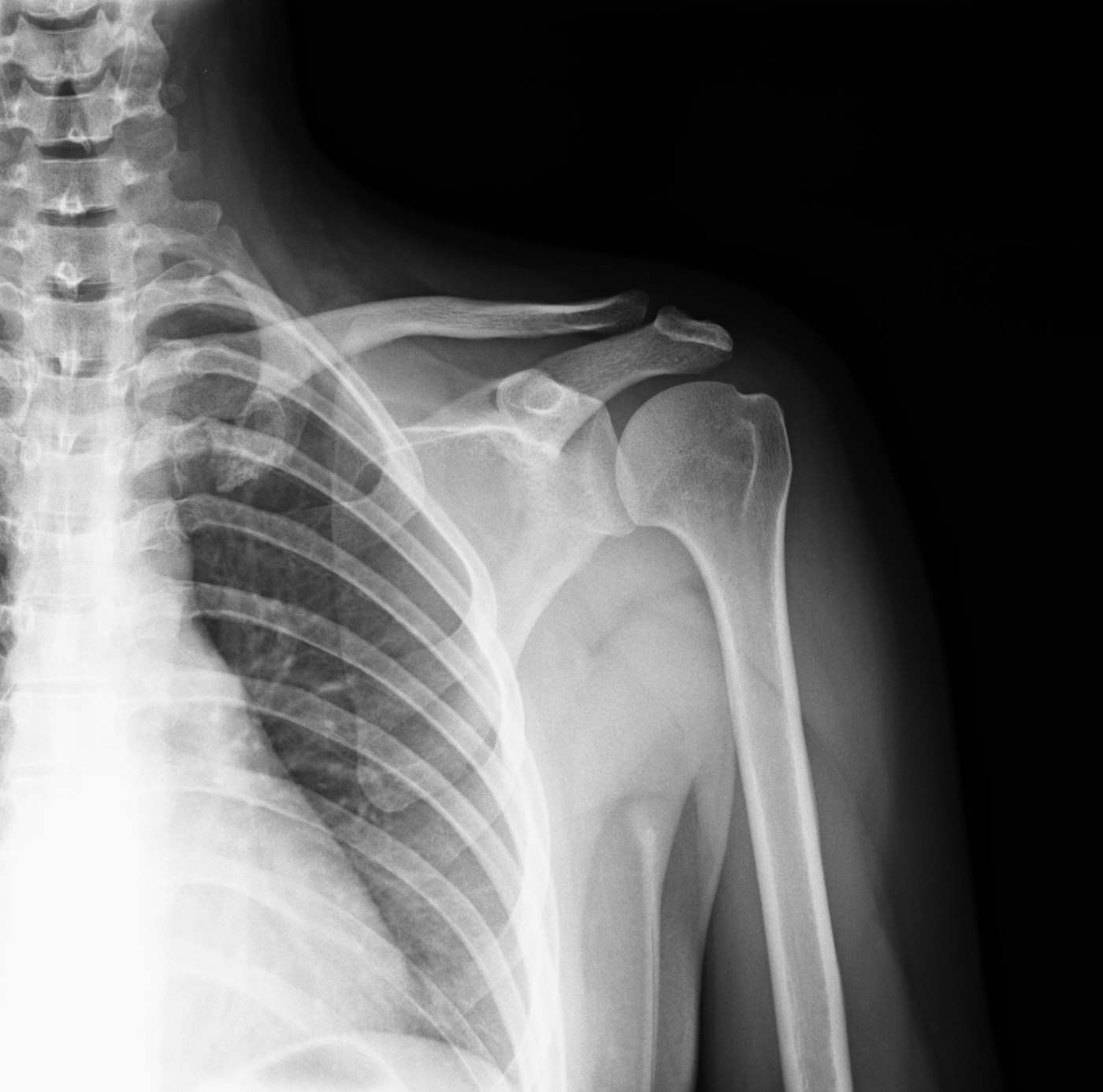 Orthopaedics – Bone & Joint